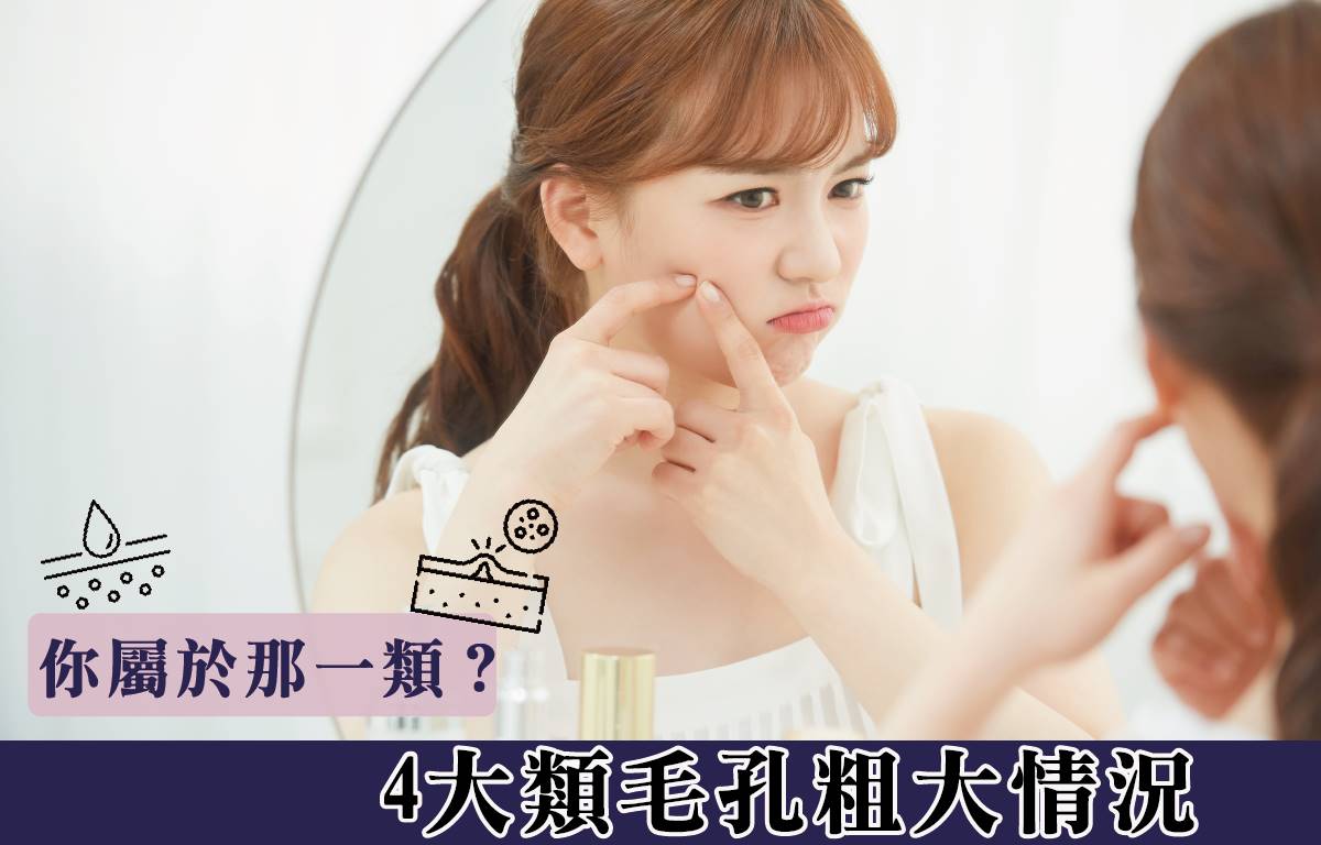 4大毛孔粗大情況 你屬於那一類？