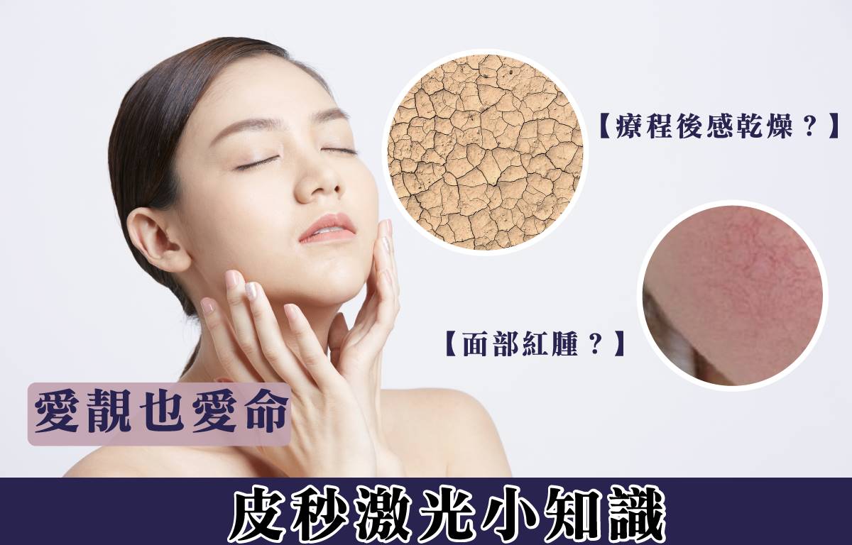 愛靚也愛命｜皮秒激光小知識