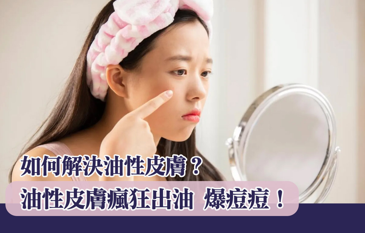 油性皮膚瘋狂出油爆痘痘！如何解決？