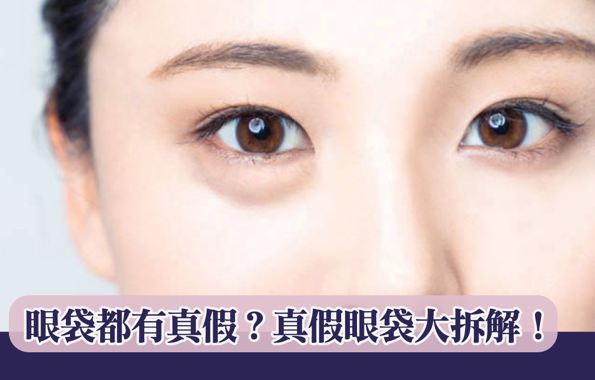 眼袋都有真假？真假眼袋大拆解！